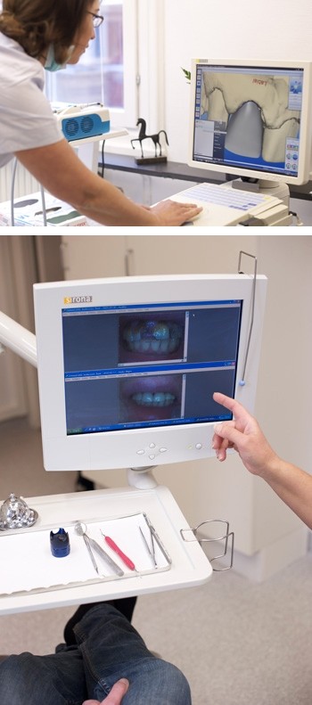 Porslinskrona enligt CAD-CAM teknik- Astondental