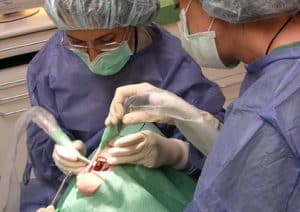 Operation tandimplantat